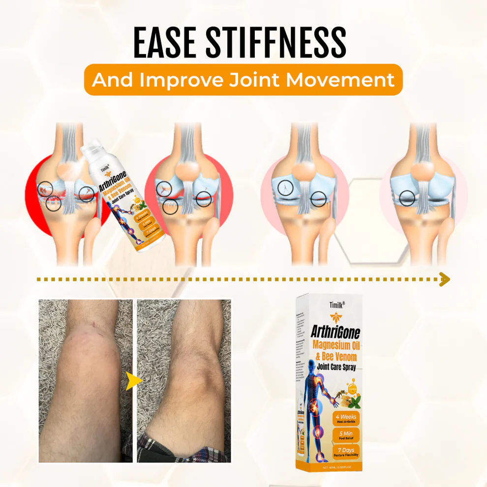 ArthriGone Magnesium Oil & Bee Venom Joint Care Spray 7 ArthriGone Magnesium Oil & Bee Venom Joint Care Spray