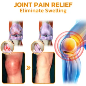 Best Deal flysmus™ Bee-Venom Pain-Relief Bone Healing Cream