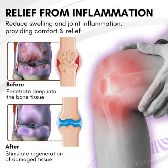 Cvreoz® Turmeric & Emu Oil Arthritis Soothing Pain Relief Massage Gel 5 Cvreoz® Turmeric & Emu Oil Arthritis Soothing Pain Relief Massage Gel