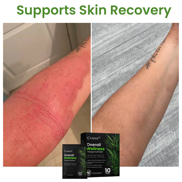 Cvreoz® Overall Wellness Therapy Foot Patch 10 Cvreoz® Overall Wellness Therapy Foot Patch