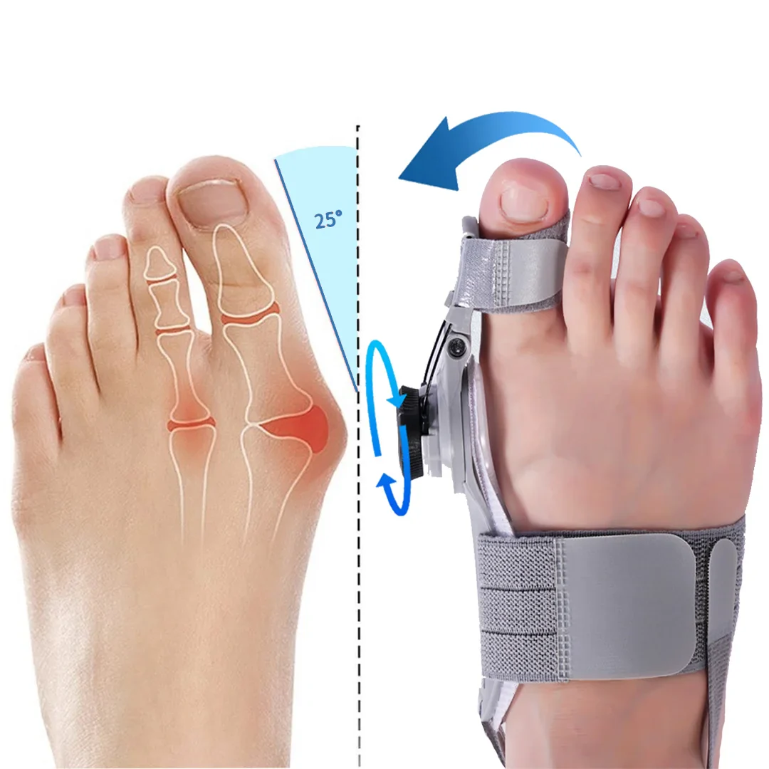 Bonex Bunion Fix 2 Bonex Bunion Fix