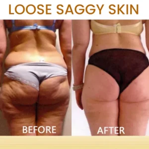 AEXZR® Bee Venom Skin Treatment Soap 19 AEXZR® Bee Venom Skin Treatment Soap