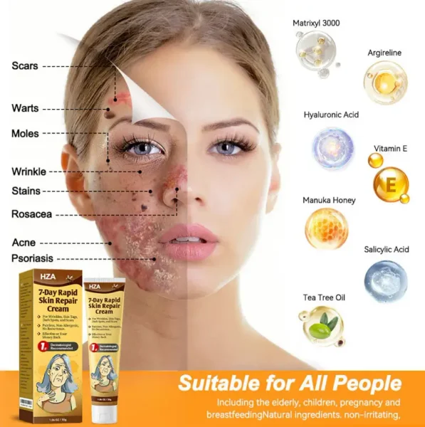 HZA 7-Day Rapid Skin Repair Cream UK Dermatologist Approved 1 HZA 7-Day Rapid Skin Repair Cream UK Dermatologist Approved