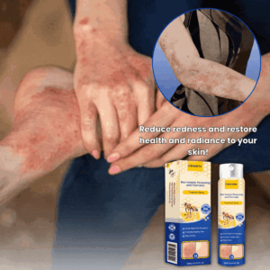 SkinClix™ | Effectively relieves itching and flaking and improves the appearance 16 SkinClix™ | Effectively relieves itching and flaking and improves the appearance