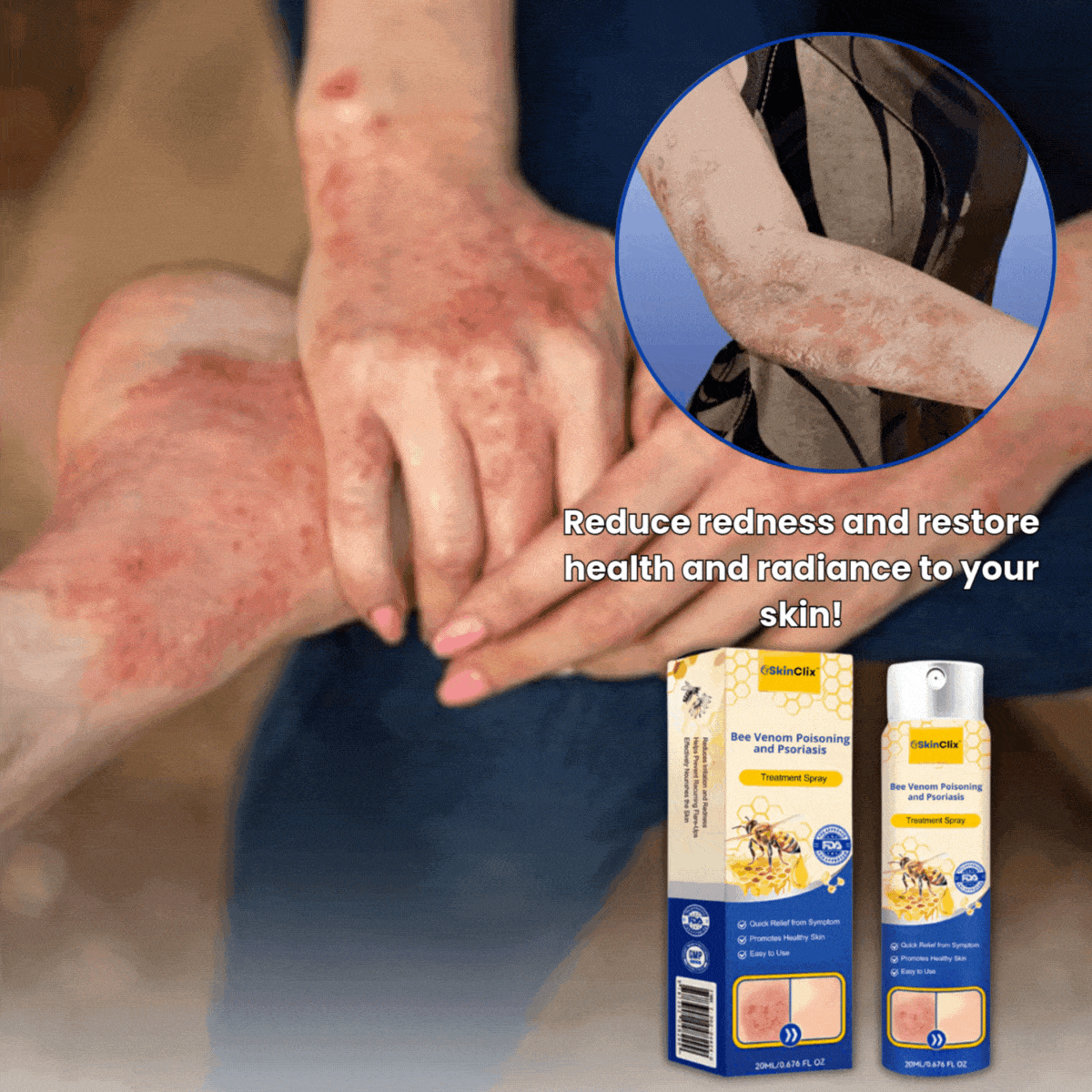 SkinClix™ | Effectively relieves itching and flaking and improves the appearance 8 SkinClix™ | Effectively relieves itching and flaking and improves the appearance - Image 8