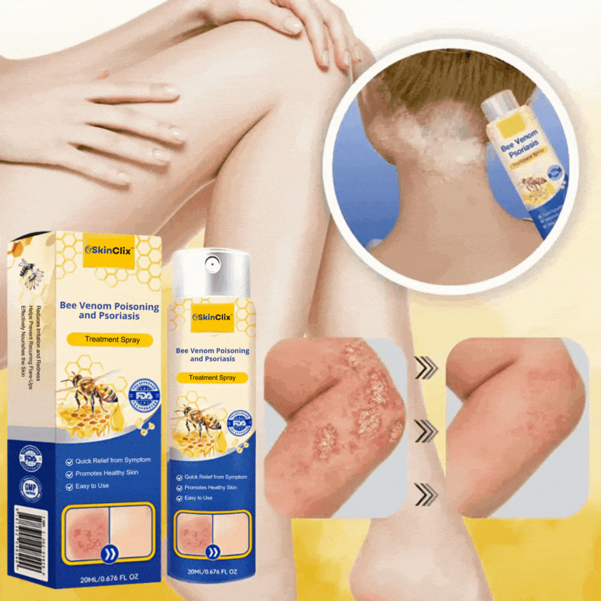 SkinClix™ | Effectively relieves itching and flaking and improves the appearance 7 SkinClix™ | Effectively relieves itching and flaking and improves the appearance - Image 7