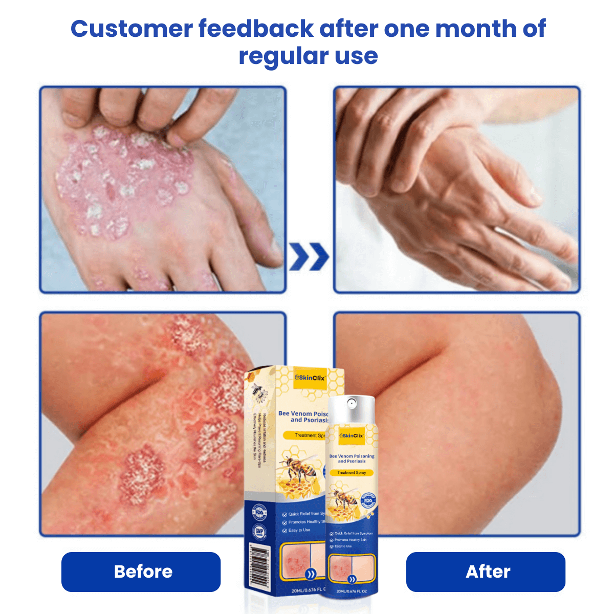 SkinClix™ | Effectively relieves itching and flaking and improves the appearance 2 SkinClix™ | Effectively relieves itching and flaking and improves the appearance - Image 2