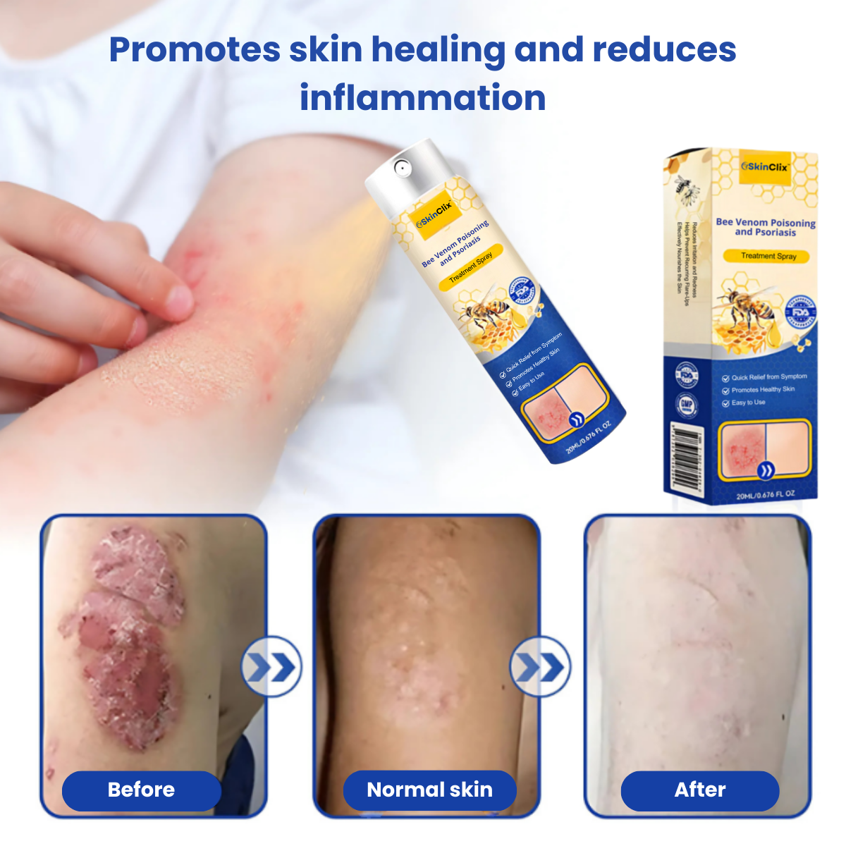 SkinClix™ | Effectively relieves itching and flaking and improves the appearance 3 SkinClix™ | Effectively relieves itching and flaking and improves the appearance - Image 3