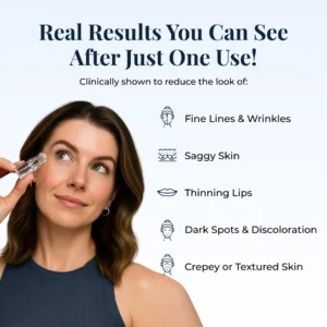 Glamory MicroLift System-Erase Years of Aging at Home in Just 5 Minutes
