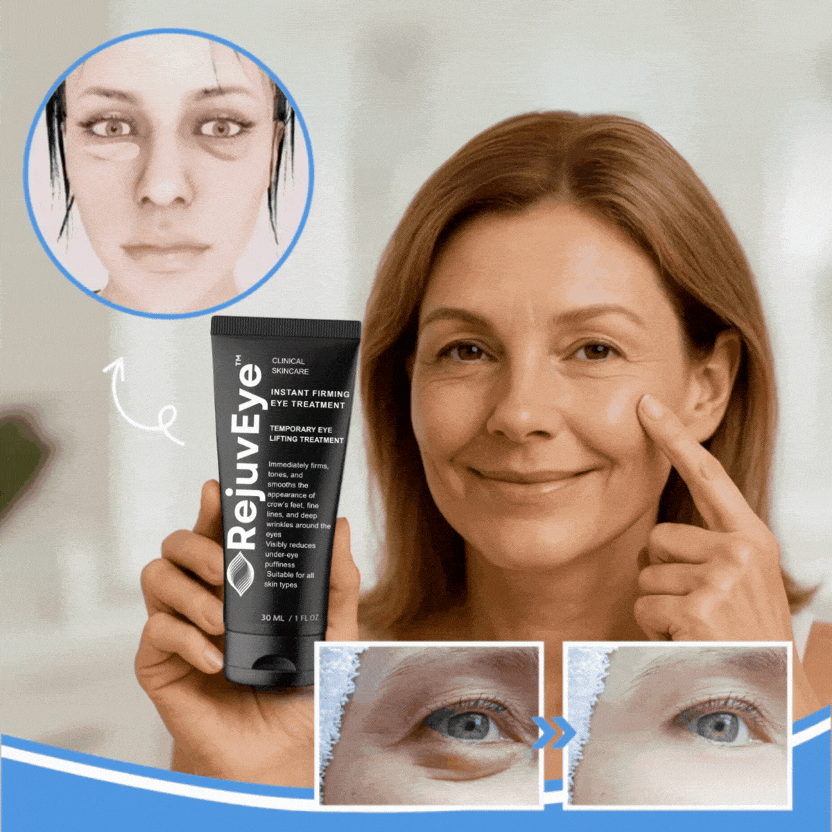 RejuvEye™ | Lift Drooping Eyelids – 92% See Visible Results in Just 5 Minutes! 3 RejuvEye™ | Lift Drooping Eyelids – 92% See Visible Results in Just 5 Minutes!