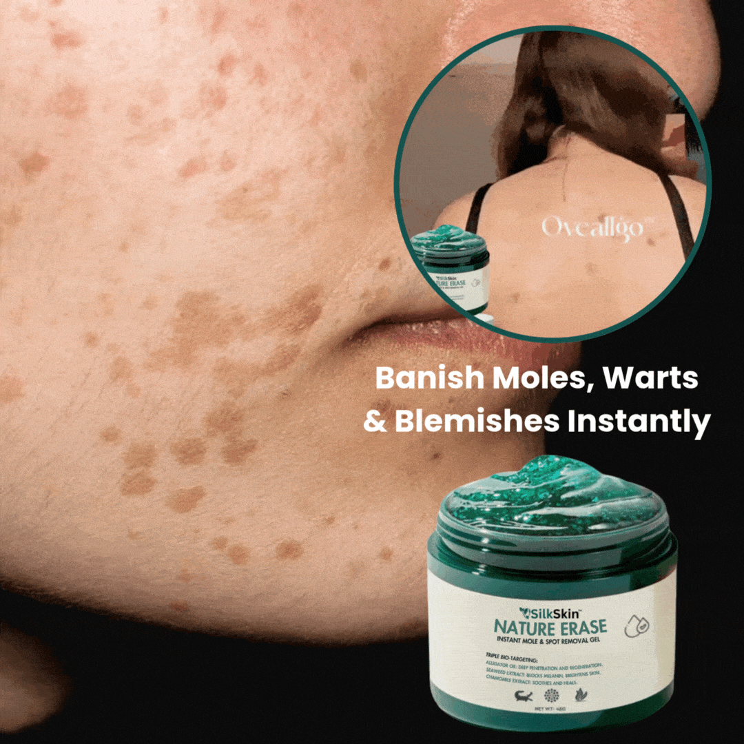 SilkSkin™ | Clinically Proven to Remove 97% of Moles, Warts & Blemishes 1 SilkSkin™ | Clinically Proven to Remove 97% of Moles, Warts & Blemishes