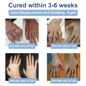 Ourlyard™ Official Store: Magnesium Pain Healing Bone Cream 18 Ourlyard™ Official Store: Magnesium Pain Healing Bone Cream