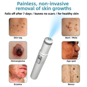 Cougex® Non-invasive Mole & Wart Removal Laser Pen