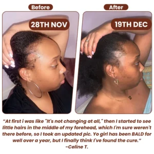 Grows Pure Batana Oil 11 Grows Pure Batana Oil