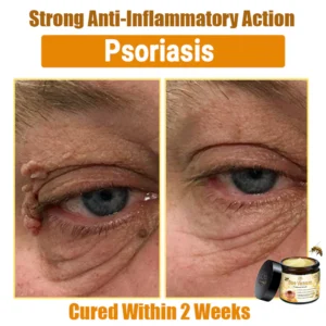 Oveallgo™ Bee Venom Skin Treatment Cream 24 Oveallgo™ Bee Venom Skin Treatment Cream