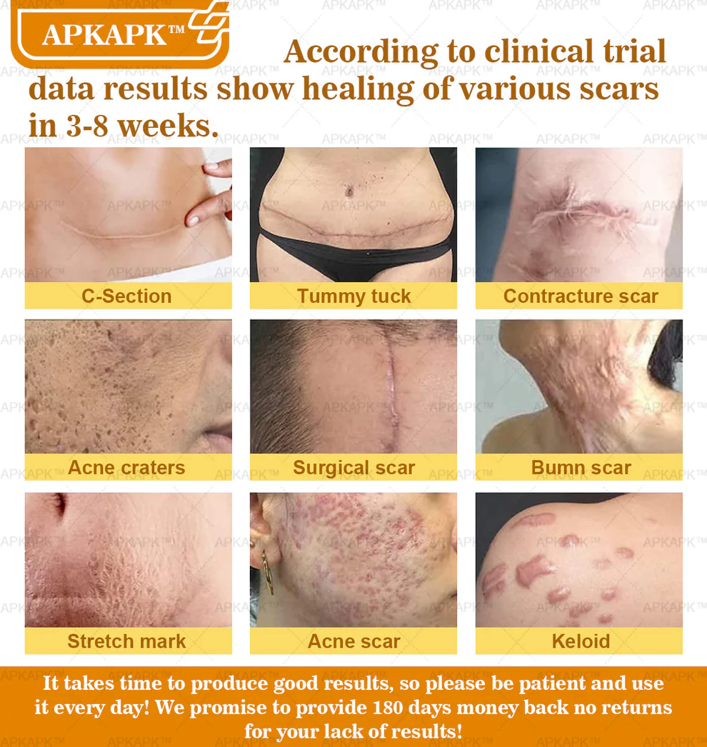 APKAPK™ Bee Venom Skin Treatment Cream 11 APKAPK™ Bee Venom Skin Treatment Cream