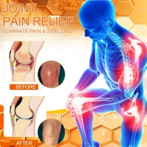 Best Deal flysmus™ Bee-Venom Pain-Relief Bone Healing Cream