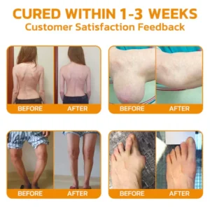 flysmus™ Bee-Venom Pain-Relief Bone Healing Cream 15 flysmus™ Bee-Venom Pain-Relief Bone Healing Cream