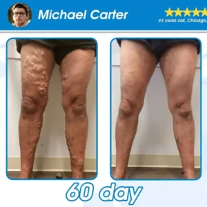 RAINDEW® GLP-1 Slimming & Health Ultra Concentrated Essence Liquid Pearls 17 RAINDEW® GLP-1 Slimming & Health Ultra Concentrated Essence Liquid Pearls