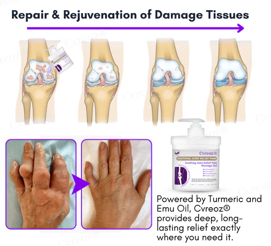 Cvreoz® Turmeric & Emu Oil Arthritis Soothing Pain Relief Massage Gel 7 Cvreoz® Turmeric & Emu Oil Arthritis Soothing Pain Relief Massage Gel