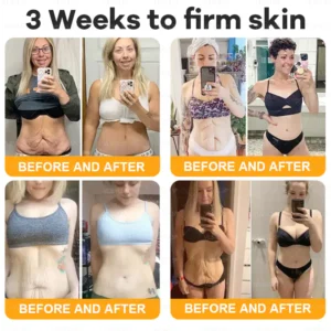 VLSVLS® Bee Venom Comprehensive Cream 19 VLSVLS® Bee Venom Comprehensive Cream