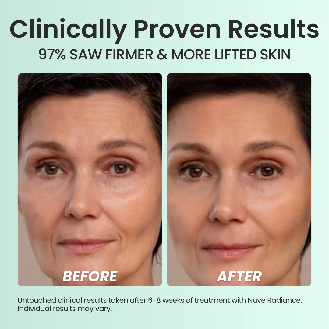 Nuve Radiance 2 Nuve Radiance