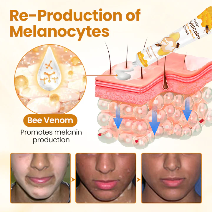 Fivfivgo® VitiCalm Bee Venom Cream 2 Fivfivgo® VitiCalm Bee Venom Cream