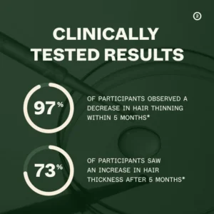 Mizorn Hair Growth Routine | For Women 9 Mizorn Hair Growth Routine | For Women