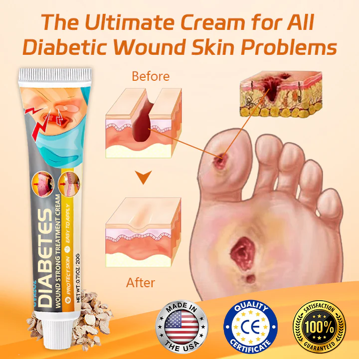 Cvreoz® Diabetes Wound Strong Treatment Cream 6 Cvreoz® Diabetes Wound Strong Treatment Cream - Image 6