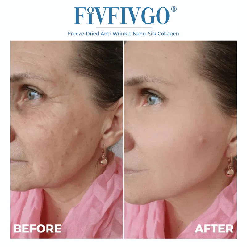 Fivfivgo® Freeze-Dried Anti-Wrinkle Nano-Silk Collagen 3 Fivfivgo® Freeze-Dried Anti-Wrinkle Nano-Silk Collagen