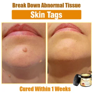 Oveallgo™ Bee Venom Skin Treatment Cream 23 Oveallgo™ Bee Venom Skin Treatment Cream