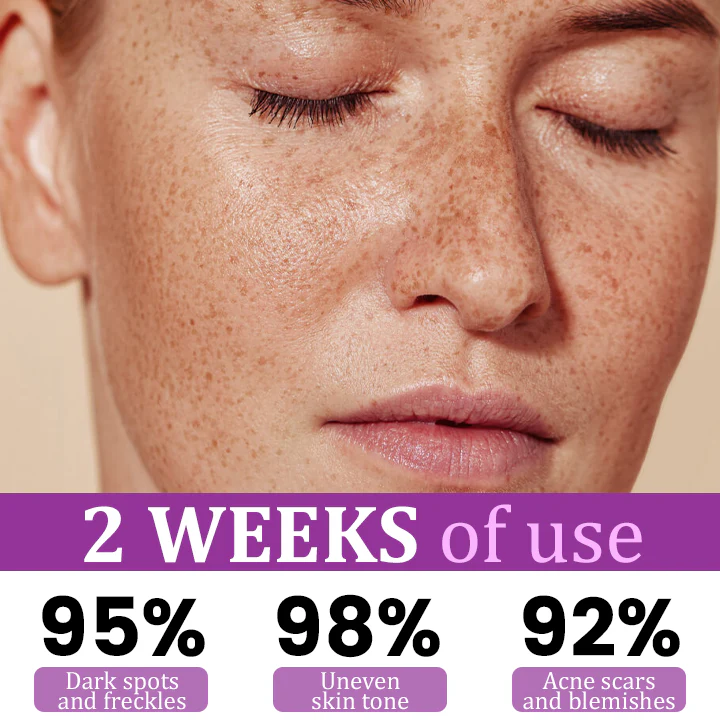 Ceoerty® MelantraX Clinical-Grade Anti-Melanin Essence 2 Ceoerty® MelantraX Clinical-Grade Anti-Melanin Ceoerty® MelantraX Clinical-Grade Anti-Melanin EssenceEssence