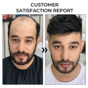 Oveallgo™ BeeGrow Follicle Reviving Hair Essence 24 Oveallgo™ BeeGrow Follicle Reviving Hair Essence