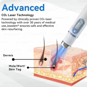 Jasseem® Non-Invasive Mole & Wart Laser Removal Pen