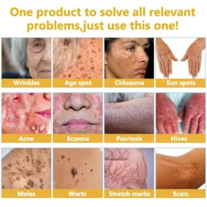 FATONG® Bee Venom Skin Treatment Essence Ampoules 12 FATONG® Bee Venom Skin Treatment Essence Ampoules