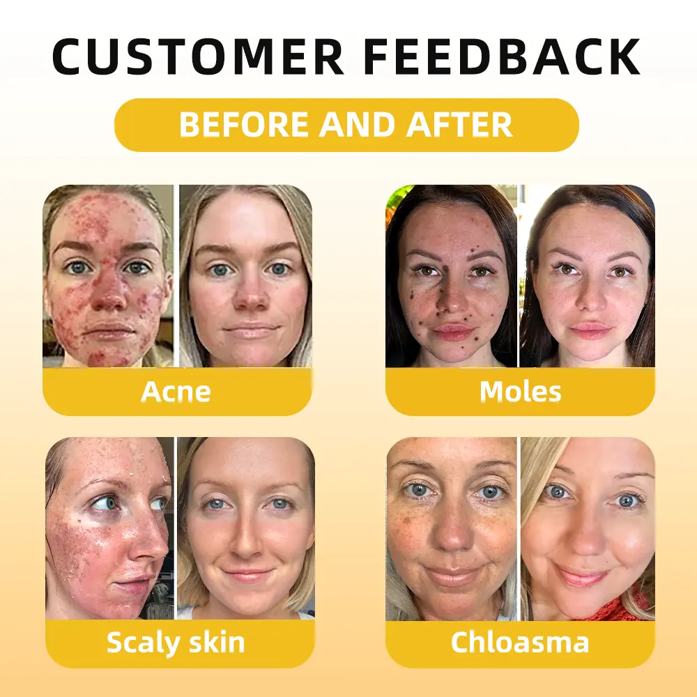 FATONG® Bee Venom Skin Treatment Essence Ampoules 7 FATONG® Bee Venom Skin Treatment Essence Ampoules - Image 7