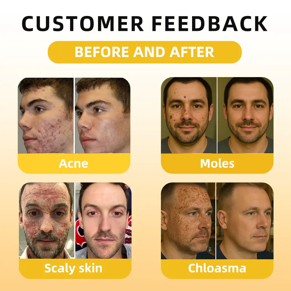 FATONG® Bee Venom Skin Treatment Essence Ampoules 8 FATONG® Bee Venom Skin Treatment Essence Ampoules - Image 8