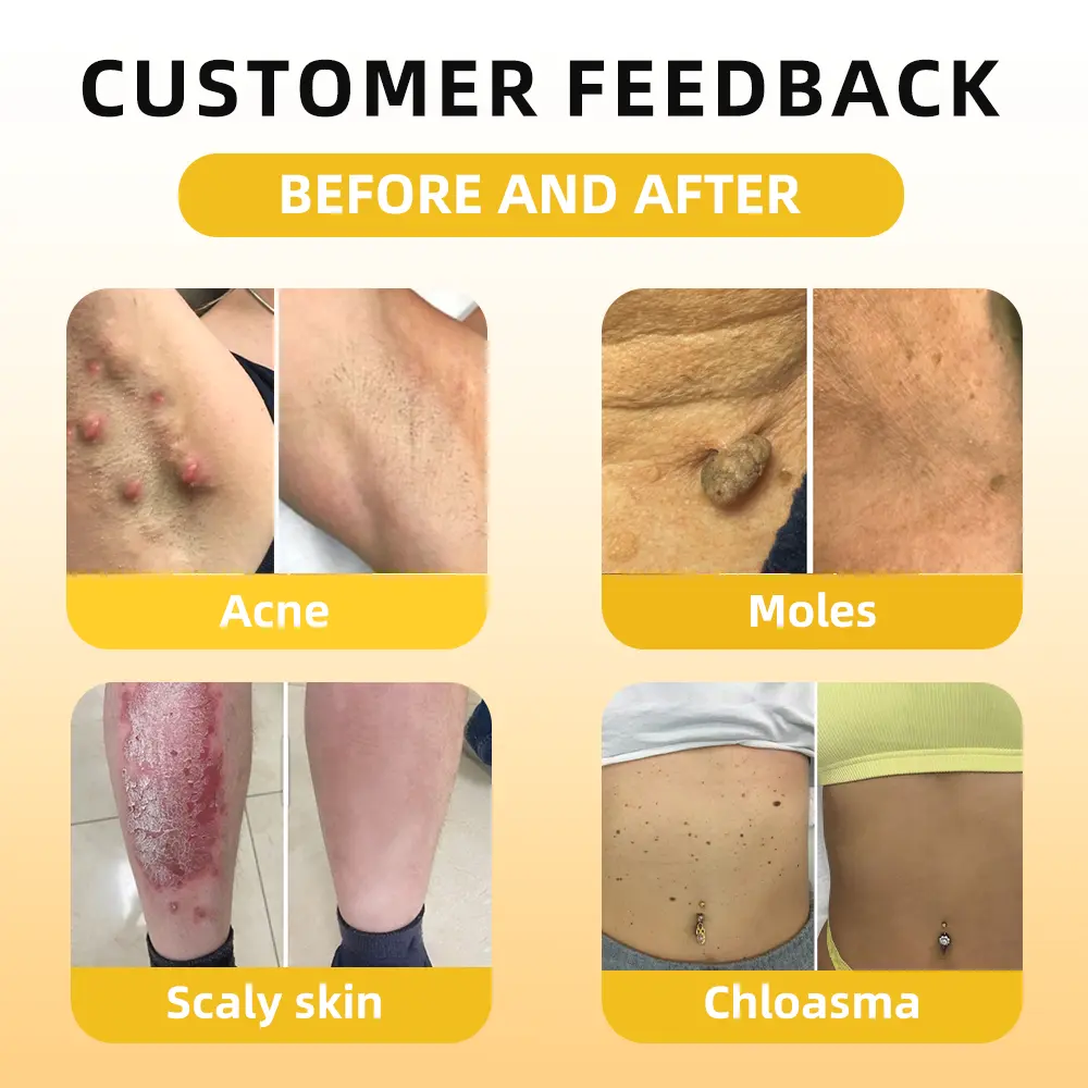 FATONG® Bee Venom Skin Treatment Essence Ampoules 9 FATONG® Bee Venom Skin Treatment Essence Ampoules - Image 9