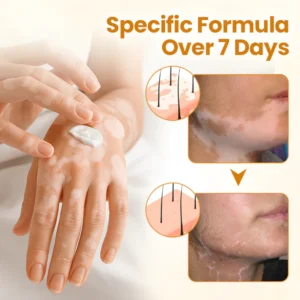 BBOJI™ VitiClear Pro Bee Toxin Cream