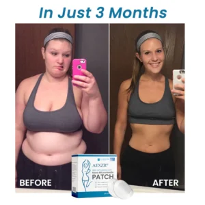 Best Deal AEXZR® SMGT-GLP1 & Matrixyl 3000 Nano Microneedle Patch 22 AEXZR® SMGT-GLP1 & Matrixyl 3000 Nano Microneedle Patch