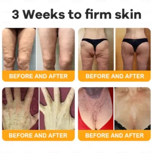 VLSVLS® Bee Venom Comprehensive Cream 18 VLSVLS® Bee Venom Comprehensive Cream