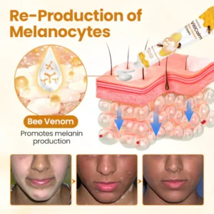 Fivfivgo® VitiCalm Bee Venom Cream 13 Fivfivgo® VitiCalm Bee Venom Cream