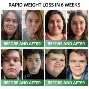 Ourlyard® Meglutide Diet Drops - Made & Shipped From Australia 16 Ourlyard® Meglutide Diet Drops - Made & Shipped From Australia