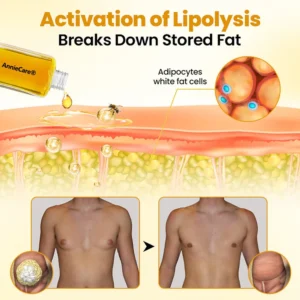 AnnieCare® ThermoFirm Bee Venom Gynecomastia-Oil AnnieCare® ThermoFirm Bee Venom Gynecomastia-Oil AnnieCare® ThermoFirm Bee Venom Gynecomastia-Oil