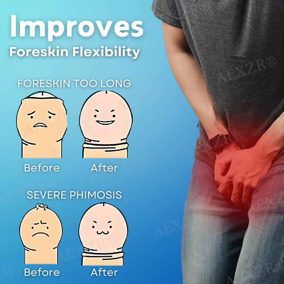 Best Deal AEXZR® Glans and Foreskin Care Cream 5 AEXZR® Glans and Foreskin Care Cream
