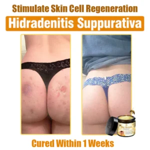 Oveallgo™ Bee Venom Skin Treatment Cream 21 Oveallgo™ Bee Venom Skin Treatment Cream