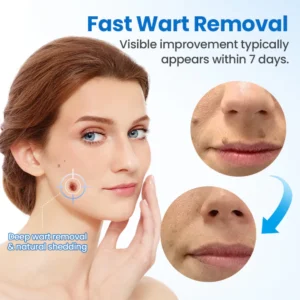 Timilk® TagGone Wart Removal Cream