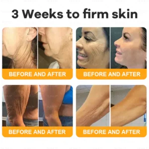 VLSVLS® Bee Venom Comprehensive Cream 17 VLSVLS® Bee Venom Comprehensive Cream