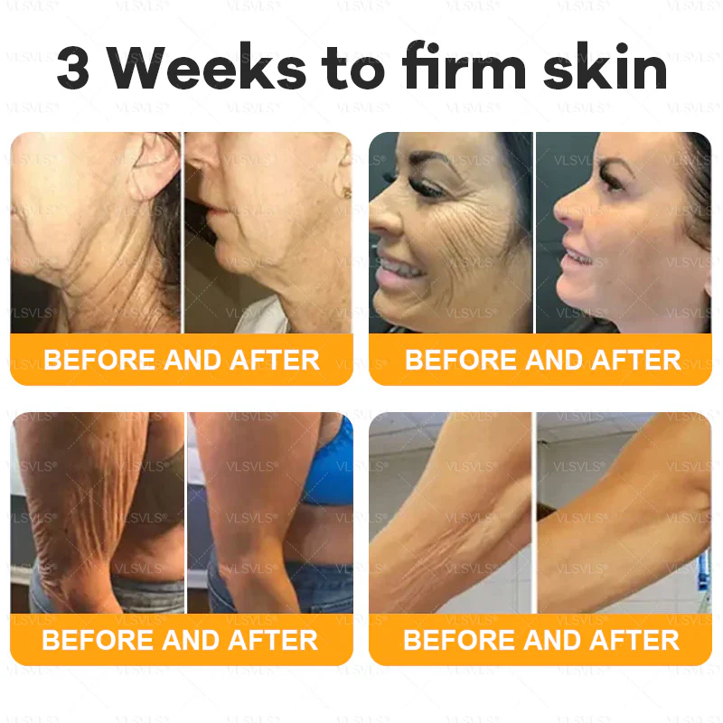 VLSVLS® Bee Venom Comprehensive Cream 8 VLSVLS® Bee Venom Comprehensive Cream - Image 8