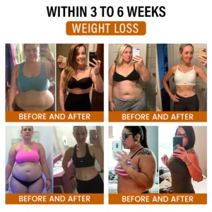 Timilk® SlimFlow Bee Venom Lymphatic Detox Foot Patches 14 Timilk® SlimFlow Bee Venom Lymphatic Detox Foot Patches